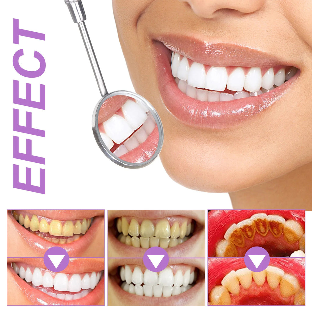 Bandes Blanchiment Dentaire Technologie Violette
