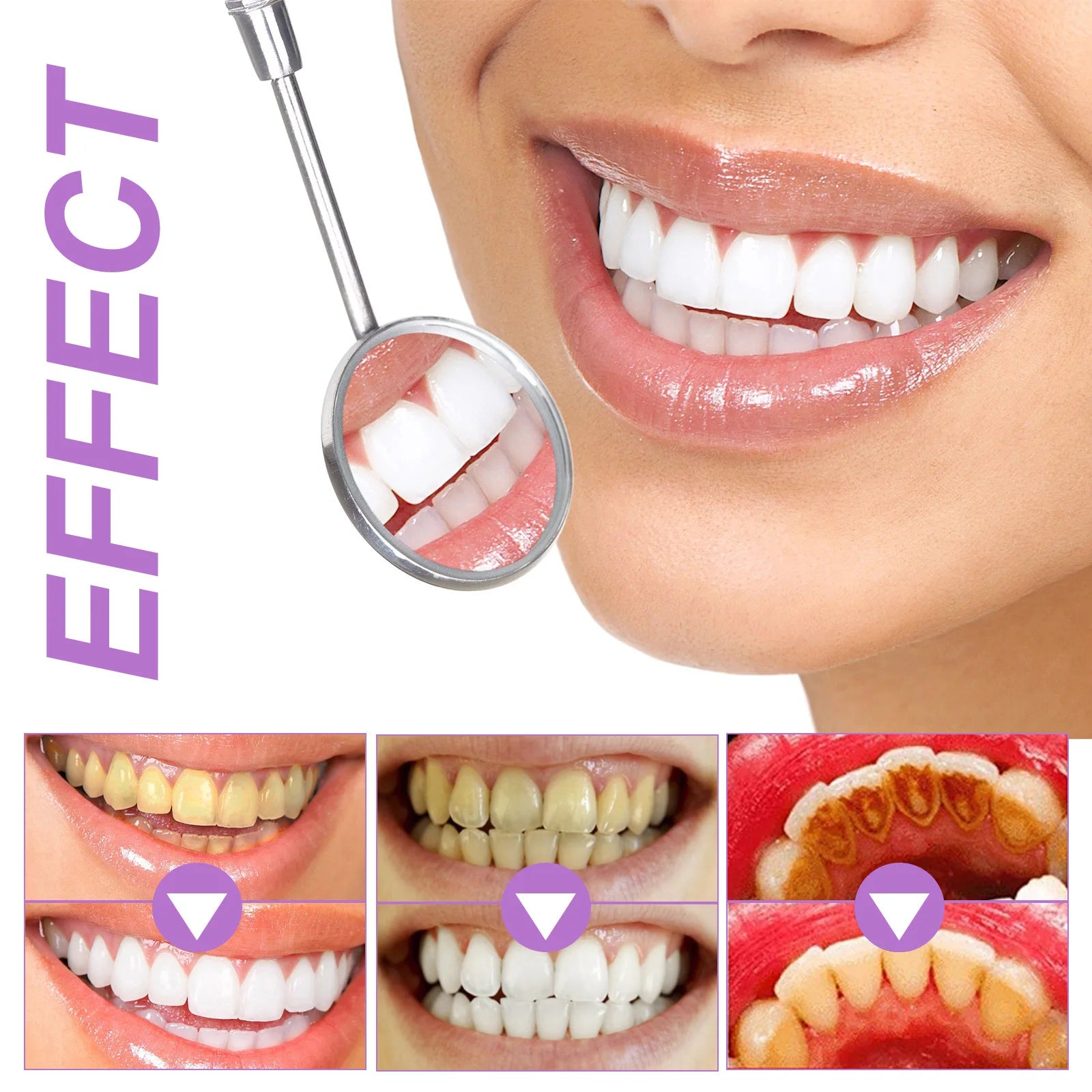 Bandes Blanchiment Dentaire Technologie Violette