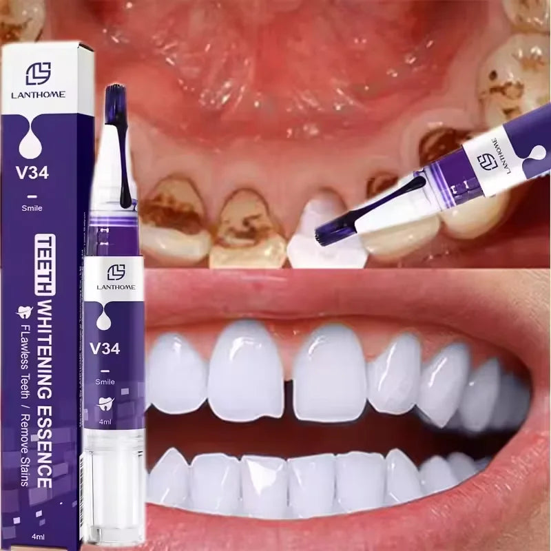 Bandes Blanchiment Dentaire Technologie Violette